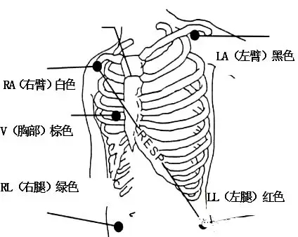 心電監(jiān)護(hù)儀1.jpg